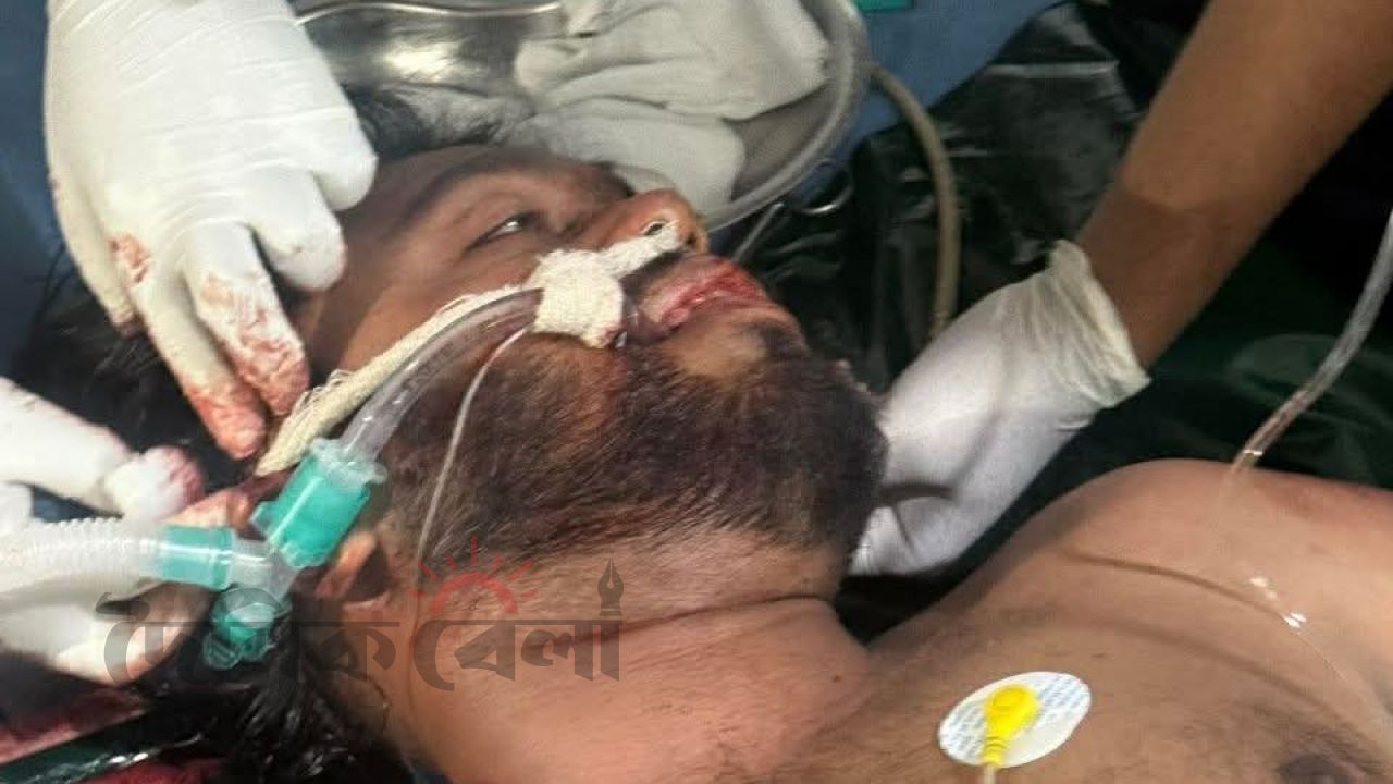 আশঙ্কাজনক অবস্থায় কোমায় আছেন ওসমান হাদী হাদি